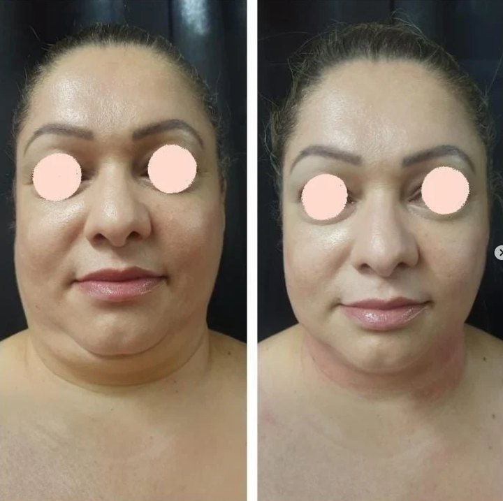 Post do Instagram da ABBA