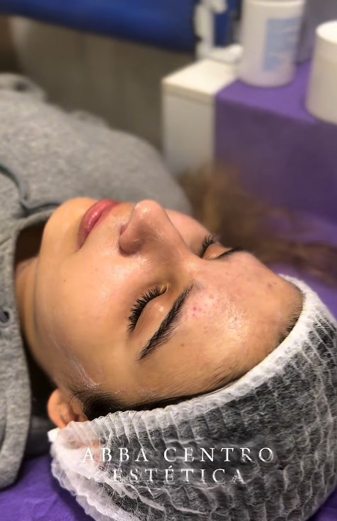 Tratamento facial