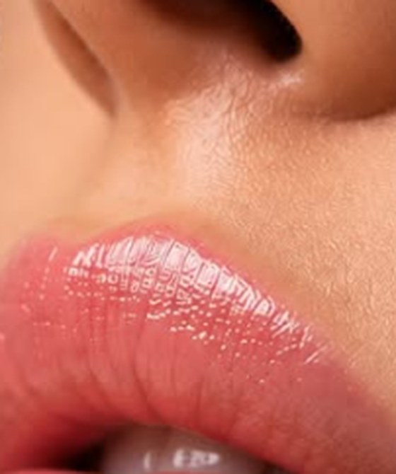 Lábios com preenchimento labial natural e harmonioso